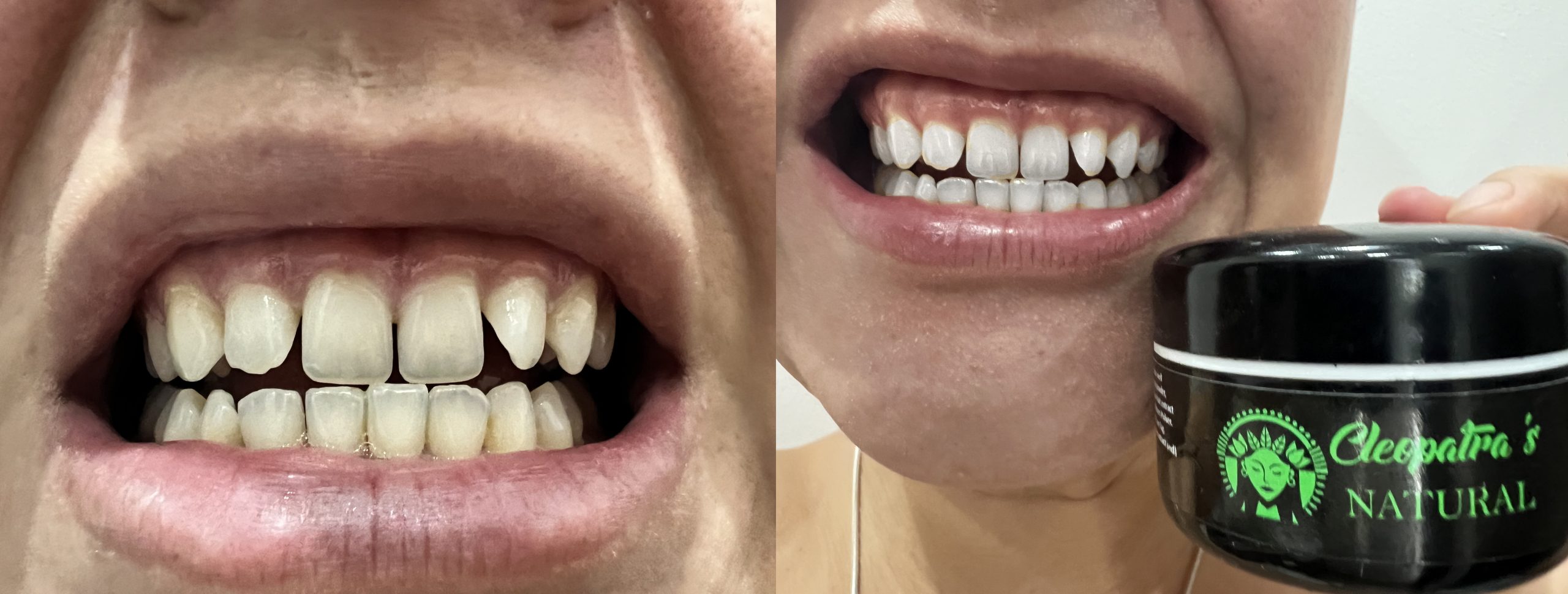harisa before after