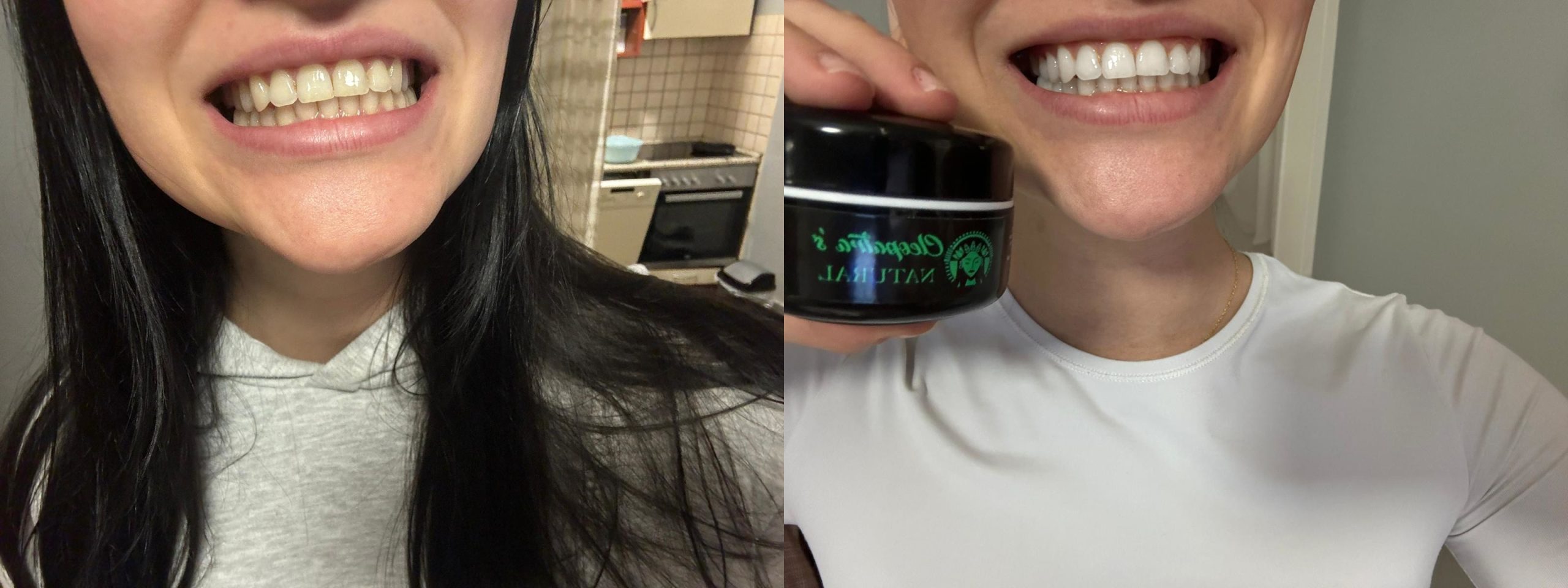 monica before after